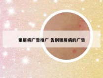 银屑病广告推广 告别银屑病的广告