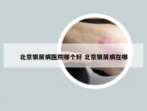北京银屑病医院哪个好 北京银屑病在哪