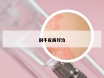副牛皮癣好治