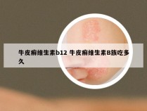 牛皮癣维生素b12 牛皮癣维生素B族吃多久