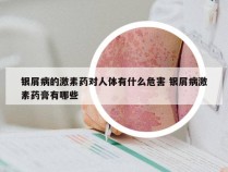 银屑病的激素药对人体有什么危害 银屑病激素药膏有哪些