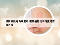 银屑病能吃乌鸡蛋吗 银屑病能吃乌鸡蛋吗百度百科