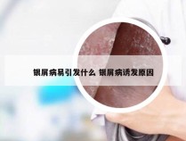银屑病易引发什么 银屑病诱发原因