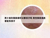男十来年银屑病可以要孩子吗 男性银屑病患者能生孩子