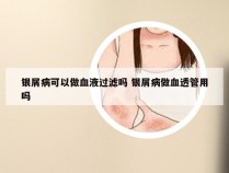 银屑病可以做血液过滤吗 银屑病做血透管用吗