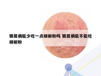 银屑病能少吃一点胡椒粉吗 银屑病能不能吃胡椒粉