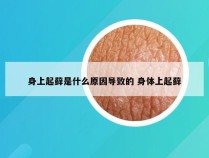 身上起藓是什么原因导致的 身体上起藓