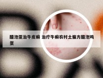 醋泡蛋治牛皮癣 治疗牛癣农村土偏方醋泡鸡蛋