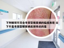 下列哪项不符合寻常型银屑病的临床表现 以下不是寻常型银屑病皮损特点的是