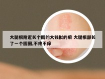 大腿根附近长个圆的大钱似的癣 大腿根部长了一个圆圈,不疼不痒