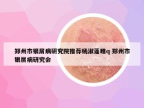 郑州市银屑病研究院推荐杨淑莲瞧q 郑州市银屑病研究会