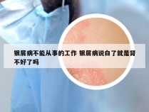 银屑病不能从事的工作 银屑病说白了就是肾不好了吗