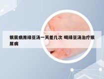 银屑病用绿豆汤一天差几次 喝绿豆汤治疗银屑病