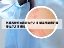 鹅掌风脚癣的最好治疗方法 鹅掌风脚癣的最好治疗方法视频