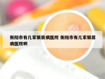 衡阳市有几家银屑病医院 衡阳市有几家银屑病医院啊