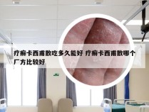 疗癣卡西甫散吃多久能好 疗癣卡西甫散哪个厂方比较好