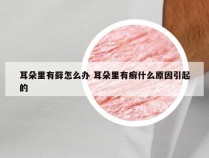 耳朵里有藓怎么办 耳朵里有癣什么原因引起的