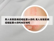 男人有银屑病结婚能要小孩吗 男人有银屑病结婚能要小孩吗有影响吗