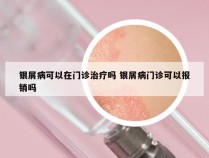 银屑病可以在门诊治疗吗 银屑病门诊可以报销吗