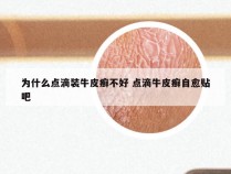 为什么点滴装牛皮癣不好 点滴牛皮癣自愈贴吧