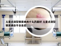 儿童点滴型银屑病用什么药最好 儿童点滴型银屑病会不会自愈