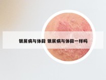 银屑病与体藓 银屑病与体藓一样吗