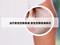 治疗脓包型银屑病 脓包型银屑病用药