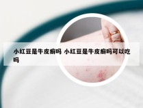 小红豆是牛皮癣吗 小红豆是牛皮癣吗可以吃吗