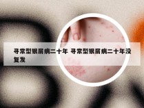 寻常型银屑病二十年 寻常型银屑病二十年没复发