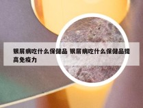 银屑病吃什么保健品 银屑病吃什么保健品提高免疫力