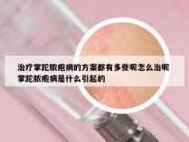 治疗掌跎脓疱病的方案都有多些呢怎么治呢 掌跎脓疱病是什么引起的