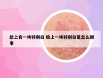 脸上有一块特别白 脸上一块特别白是怎么回事