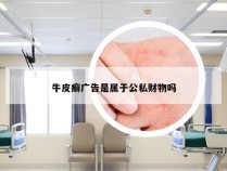 牛皮癣广告是属于公私财物吗