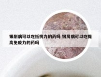 银削病可以吃抵抗力的药吗 银屑病可以吃提高免疫力的药吗