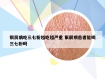 银屑病吃三七粉越吃越严重 银屑病患者能喝三七粉吗