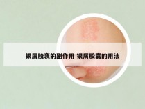 银屑胶襄的副作用 银屑胶囊的用法