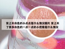 背上长白色的小点点是什么情况图片 背上长了很多白色的一点一点的小疙瘩是什么情况