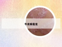 牛皮癣是龙