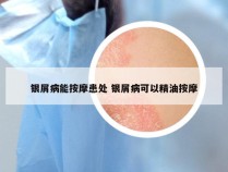 银屑病能按摩患处 银屑病可以精油按摩