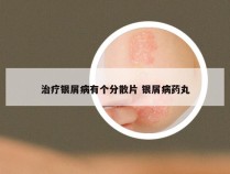 治疗银屑病有个分散片 银屑病药丸