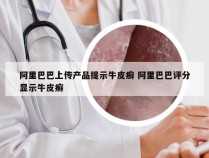 阿里巴巴上传产品提示牛皮癣 阿里巴巴评分显示牛皮癣