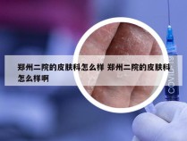 郑州二院的皮肤科怎么样 郑州二院的皮肤科怎么样啊