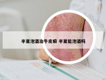 半夏泡酒治牛皮癣 半夏能泡酒吗