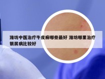 潍坊中医治疗牛皮癣哪些最好 潍坊哪里治疗银屑病比较好
