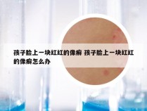 孩子脸上一块红红的像癣 孩子脸上一块红红的像癣怎么办