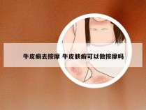 牛皮癣去按摩 牛皮肤癣可以做按摩吗