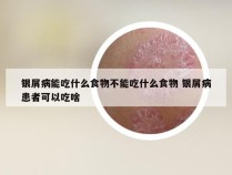 银屑病能吃什么食物不能吃什么食物 银屑病患者可以吃啥