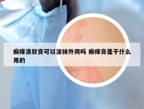癣痒清软膏可以涂抹外阴吗 癣痒膏是干什么用的