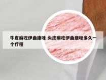 牛皮癣吃伊曲康唑 头皮癣吃伊曲康唑多久一个疗程