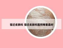 宿迁皮肤科 宿迁皮肤科医院哪里最好